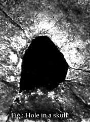 The Auger Photo Archive